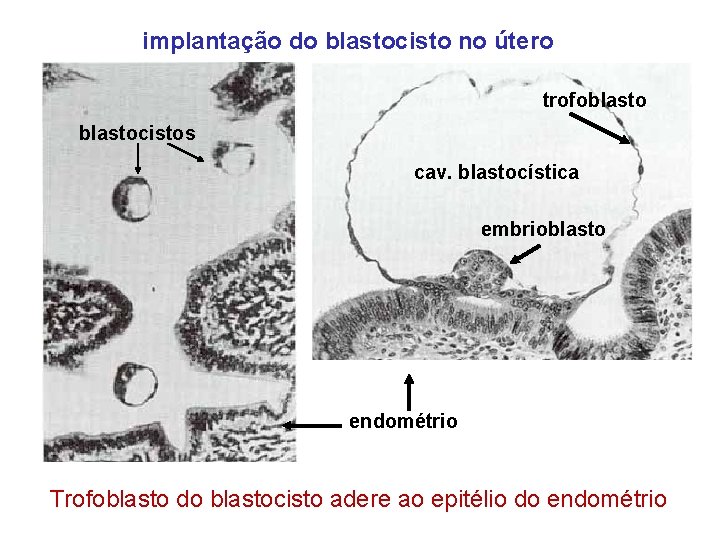 implantação do blastocisto no útero trofoblastocistos cav. blastocística embrioblasto endométrio Trofoblasto do blastocisto adere