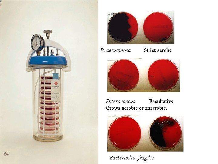 P. aeruginosa Strict aerobe Enterococcus Facultative Grows aerobic or anaerobic. 24 Bacteriodes fragilis 