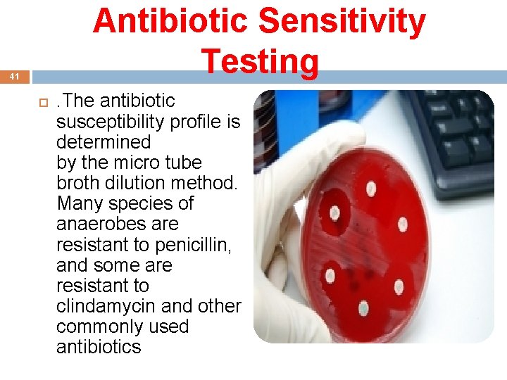 Antibiotic Sensitivity Testing 41 . The antibiotic susceptibility profile is determined by the micro