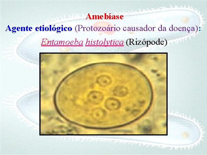 Amebíase Agente etiológico (Protozoário causador da doença): Entamoeba histolytica (Rizópode) 