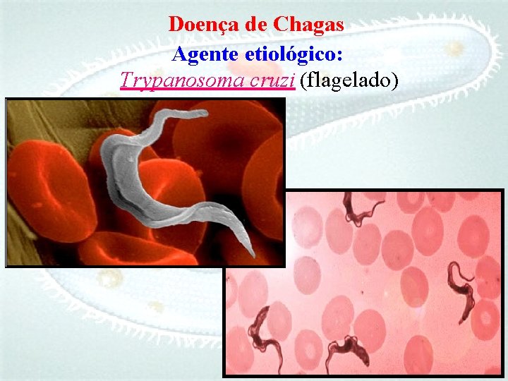 Doença de Chagas Agente etiológico: Trypanosoma cruzi (flagelado) 