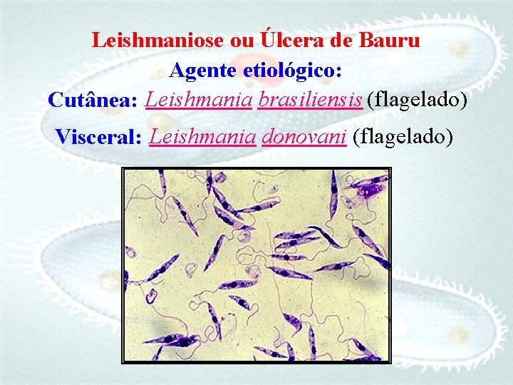 Leishmaniose ou Úlcera de Bauru Agente etiológico: Cutânea: Leishmania brasiliensis (flagelado) Visceral: Leishmania donovani