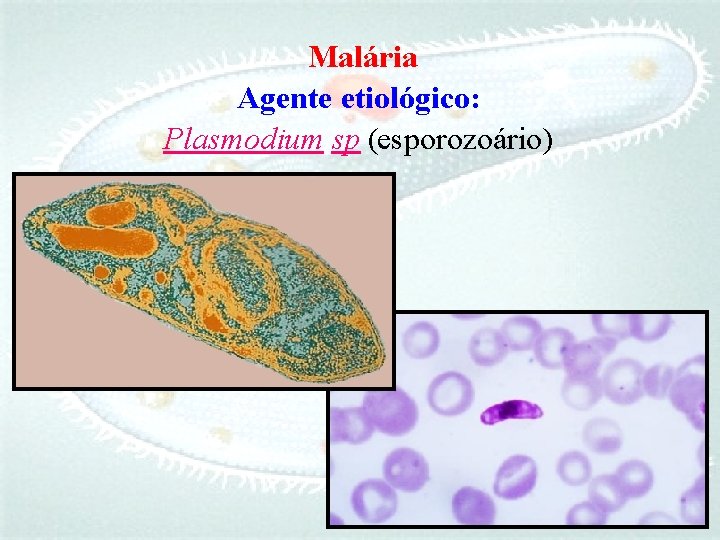 Malária Agente etiológico: Plasmodium sp (esporozoário) 