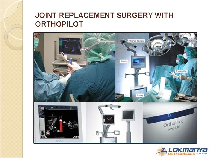 JOINT REPLACEMENT SURGERY WITH ORTHOPILOT 