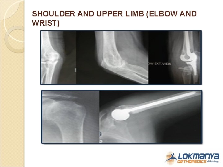 SHOULDER AND UPPER LIMB (ELBOW AND WRIST) 