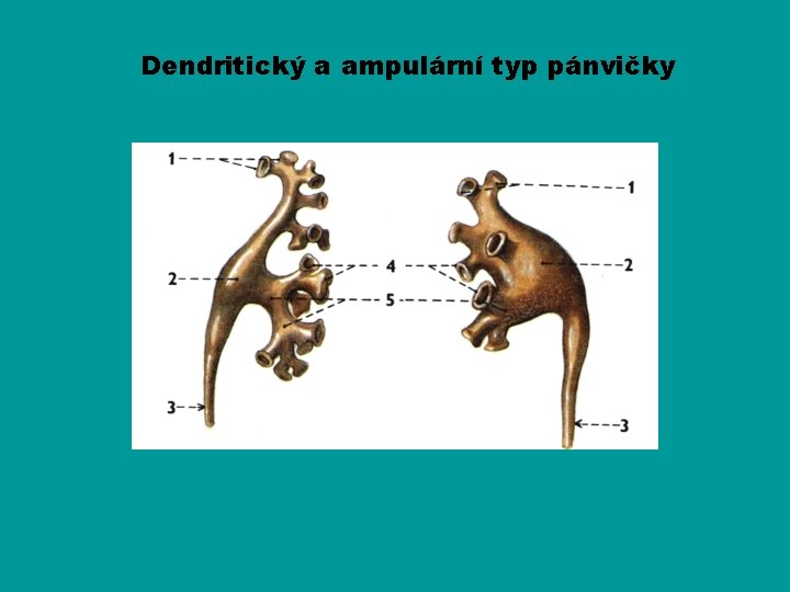 Dendritický a ampulární typ pánvičky 