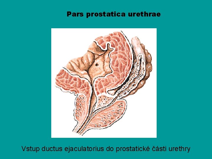 Pars prostatica urethrae Vstup ductus ejaculatorius do prostatické části urethry 