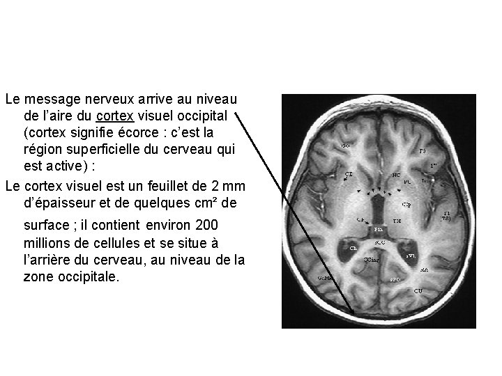 Le message nerveux arrive au niveau de l’aire du cortex visuel occipital (cortex signifie