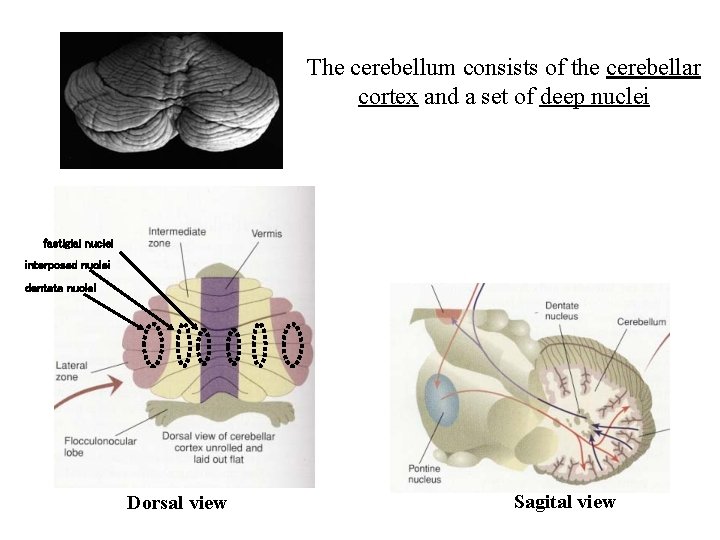The cerebellum consists of the cerebellar cortex and a set of deep nuclei fastigial