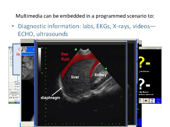 Multimedia can be embedded in a programmed scenario to: • Diagnostic information: labs, EKGs,