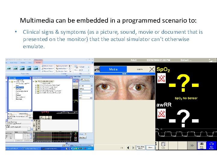 Multimedia can be embedded in a programmed scenario to: • Clinical signs & symptoms