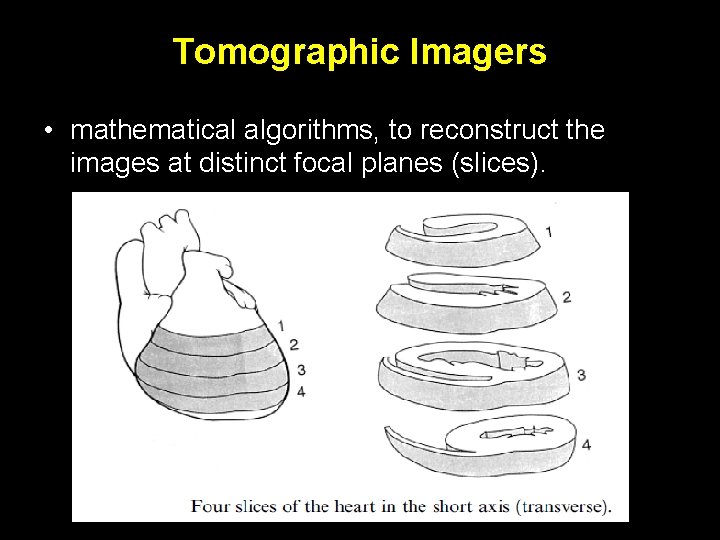 Tomographic Imagers • mathematical algorithms, to reconstruct the images at distinct focal planes (slices).
