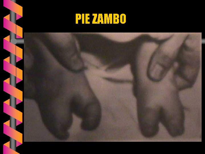 PIE ZAMBO 