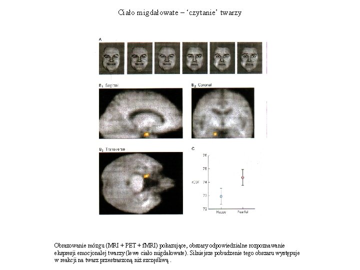 Ciało migdałowate – ‘czytanie’ twarzy Obrazowanie mózgu (MRI + PET + f. MRI) pokazujące,