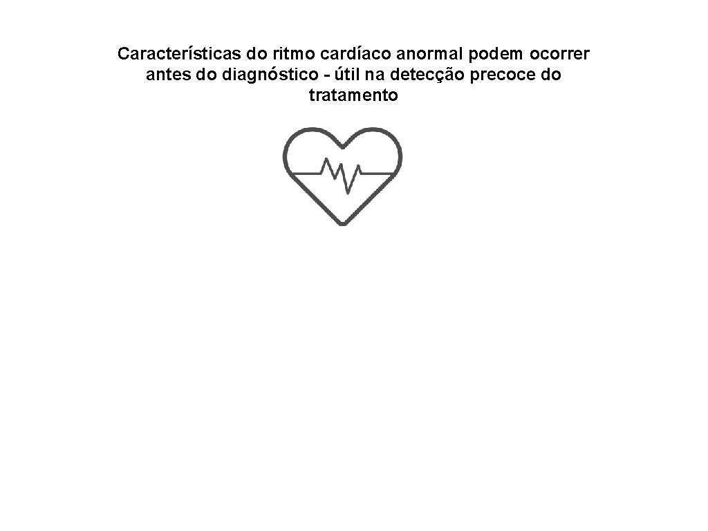 Características do ritmo cardíaco anormal podem ocorrer antes do diagnóstico - útil na detecção