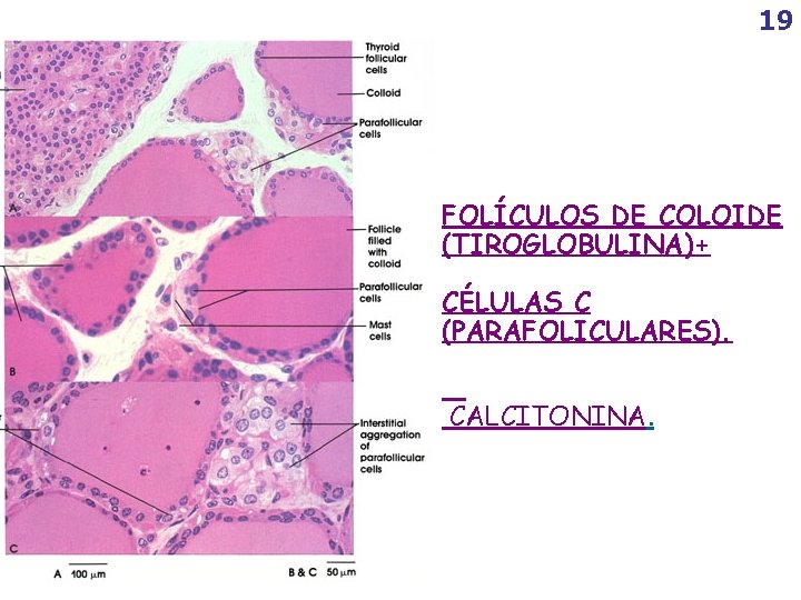 19 FOLÍCULOS DE COLOIDE (TIROGLOBULINA)+ CÉLULAS C (PARAFOLICULARES). CALCITONINA. 