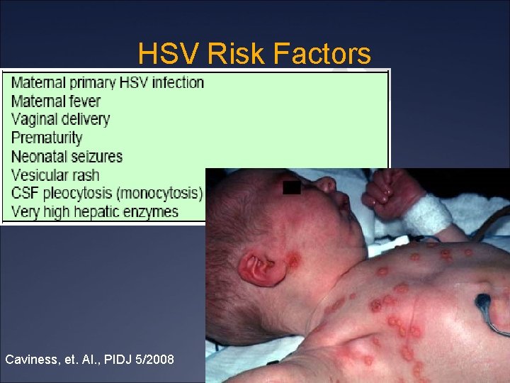 HSV Risk Factors Caviness, et. Al. , PIDJ 5/2008 