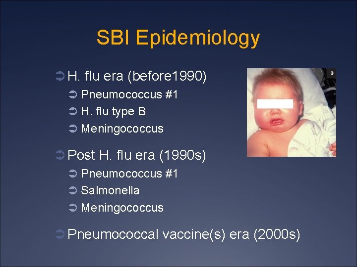 SBI Epidemiology Ü H. flu era (before 1990) Ü Pneumococcus #1 Ü H. flu