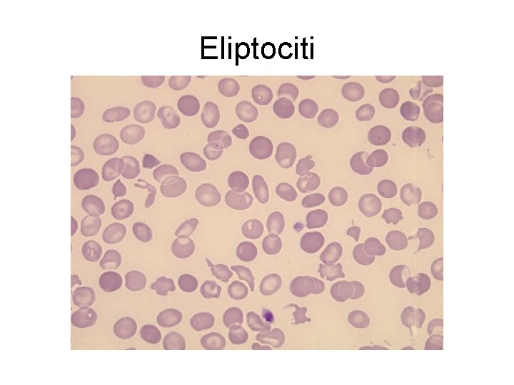 Eliptociti 