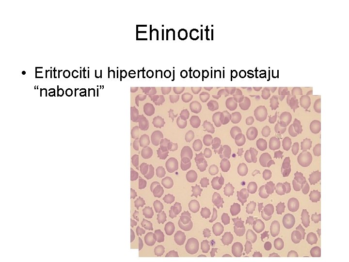 Ehinociti • Eritrociti u hipertonoj otopini postaju “naborani” 