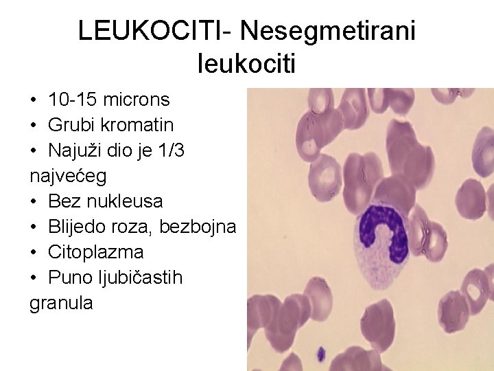 LEUKOCITI- Nesegmetirani leukociti • 10 -15 microns • Grubi kromatin • Najuži dio je