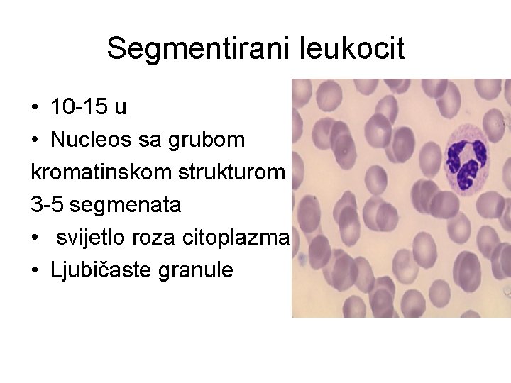 Segmentirani leukocit • 10 -15 u • Nucleos sa grubom kromatinskom strukturom 3 -5