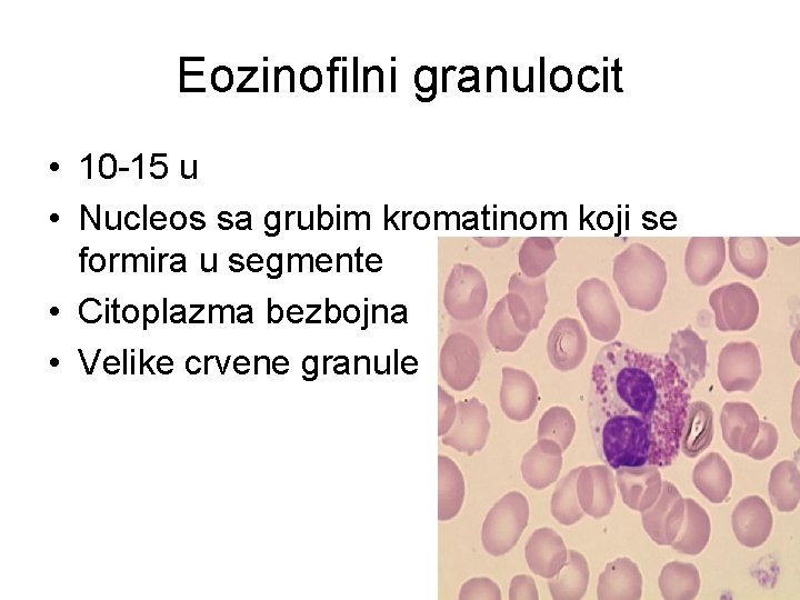 Eozinofilni granulocit • 10 -15 u • Nucleos sa grubim kromatinom koji se formira