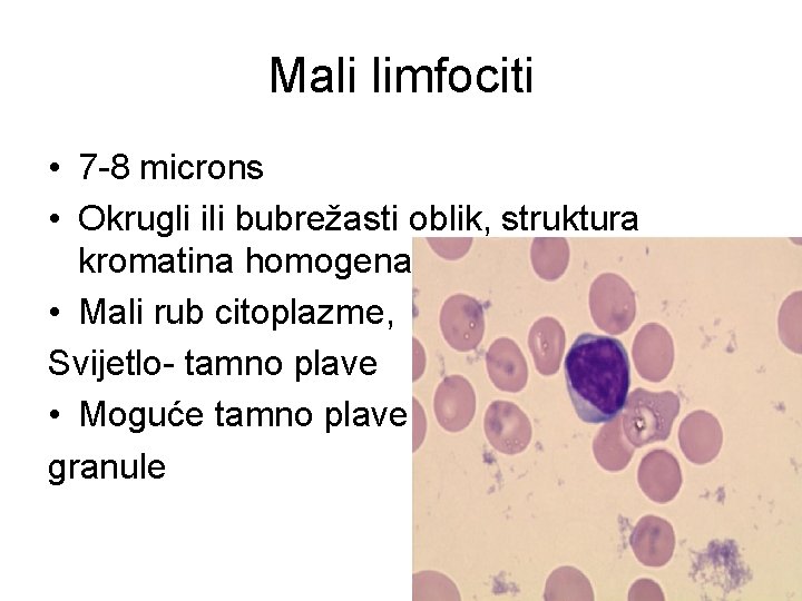 Mali limfociti • 7 -8 microns • Okrugli ili bubrežasti oblik, struktura kromatina homogena