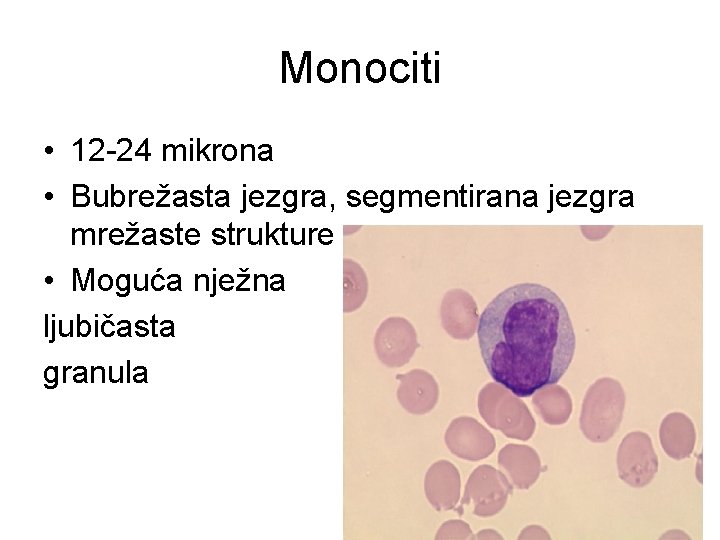 Monociti • 12 -24 mikrona • Bubrežasta jezgra, segmentirana jezgra mrežaste strukture • Moguća