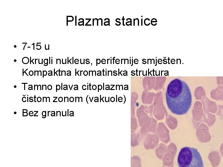 Plazma stanice • 7 -15 u • Okrugli nukleus, perifernije smješten. Kompaktna kromatinska struktura