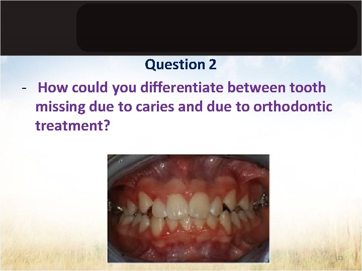 Question 2 - How could you differentiate between tooth missing due to caries and