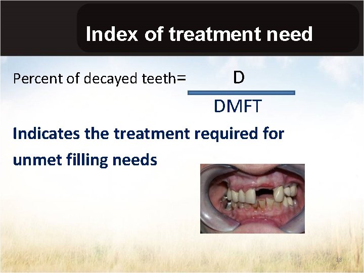 Index of treatment need Percent of decayed teeth= D DMFT Indicates the treatment required
