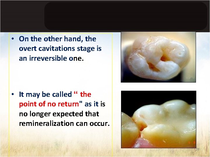  • On the other hand, the overt cavitations stage is an irreversible one.