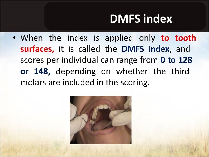 DMFS index • When the index is applied only to tooth surfaces, it is