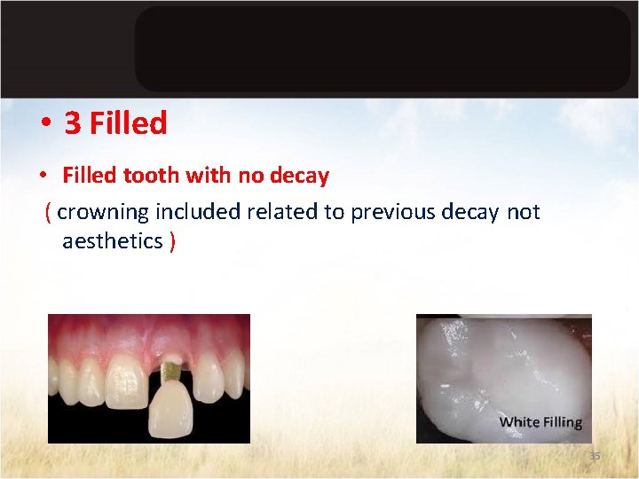  • 3 Filled • Filled tooth with no decay ( crowning included related