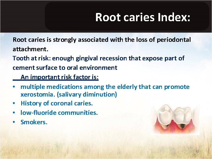 Root caries Index: Root caries is strongly associated with the loss of periodontal attachment.