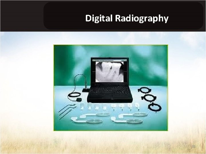 Digital Radiography 51 