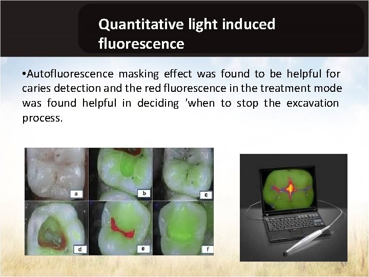 Quantitative light induced fluorescence • Autofluorescence masking effect was found to be helpful for