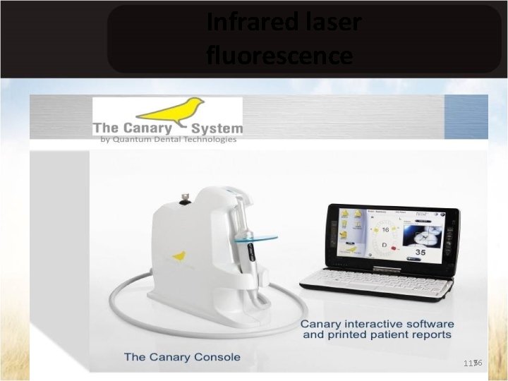 Infrared laser fluorescence 11756 