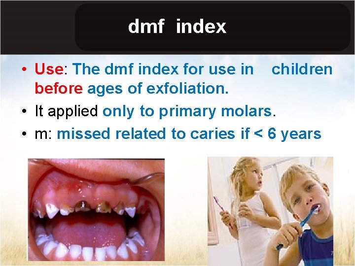 dmf index • Use: The dmf index for use in children before ages of