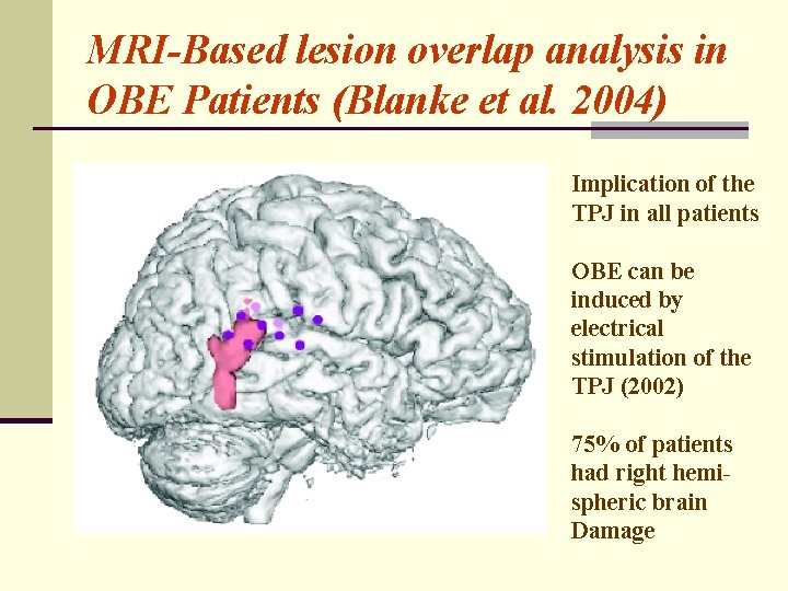 MRI-Based lesion overlap analysis in OBE Patients (Blanke et al. 2004) Implication of the