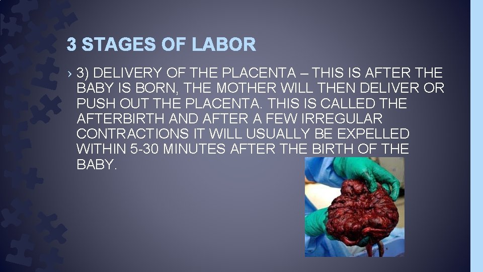 3 STAGES OF LABOR › 3) DELIVERY OF THE PLACENTA – THIS IS AFTER