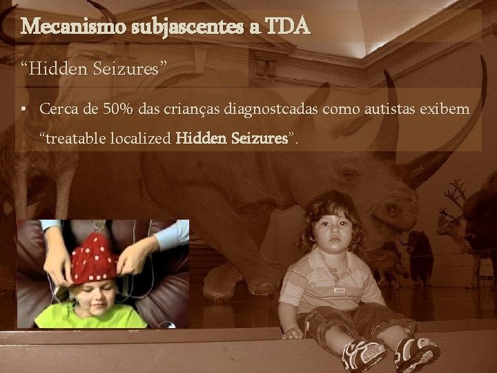 Mecanismo subjascentes a TDA “Hidden Seizures” • Cerca de 50% das crianças diagnostcadas como