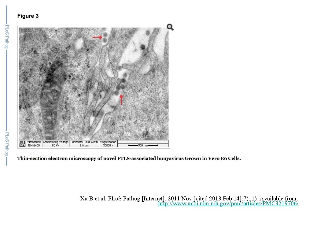 Xu B et al. PLo. S Pathog [Internet]. 2011 Nov [cited 2013 Feb 14];