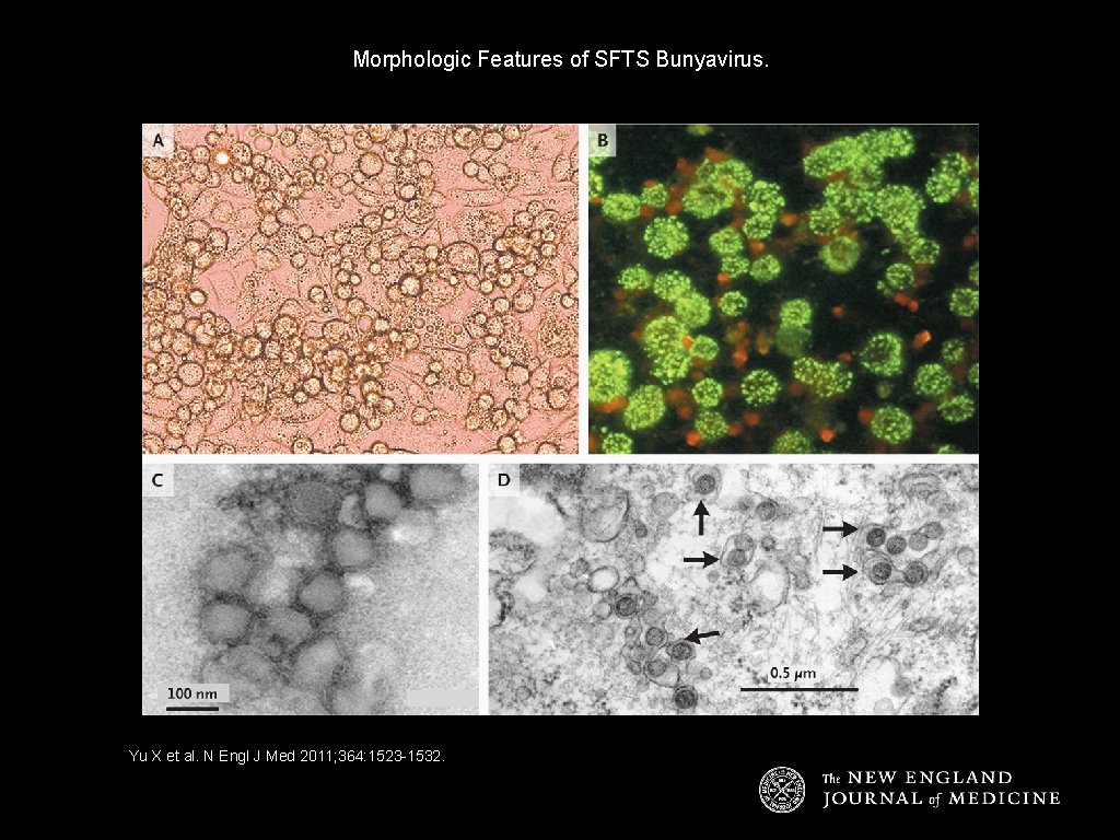Morphologic Features of SFTS Bunyavirus. Yu X et al. N Engl J Med 2011;