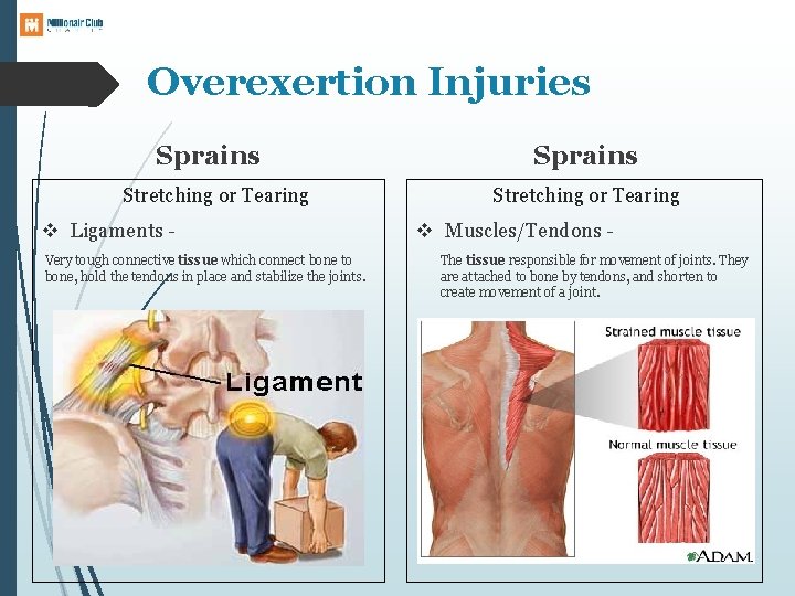 Overexertion Injuries Sprains Stretching or Tearing v Ligaments Very tough connective tissue which connect
