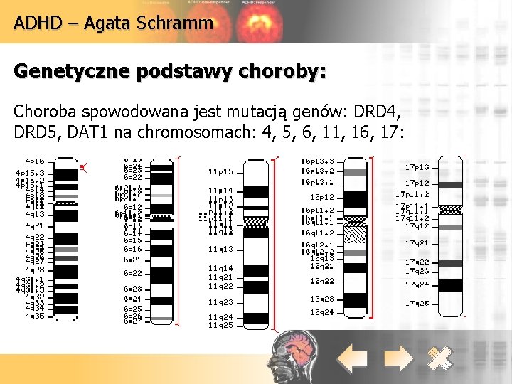 ADHD – Agata Schramm Genetyczne podstawy choroby: Choroba spowodowana jest mutacją genów: DRD 4, ADHD – Agata Schramm Genetyczne podstawy choroby: Choroba spowodowana jest mutacją genów: DRD 4,