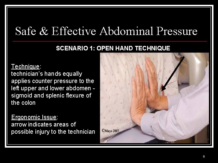 Safe & Effective Abdominal Pressure SCENARIO 1: OPEN HAND TECHNIQUE Technique: technician’s hands equally