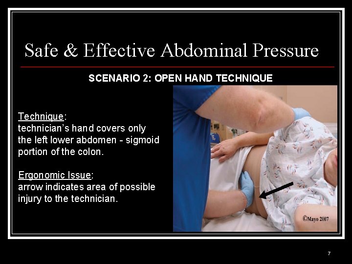 Safe & Effective Abdominal Pressure SCENARIO 2: OPEN HAND TECHNIQUE Technique: technician’s hand covers