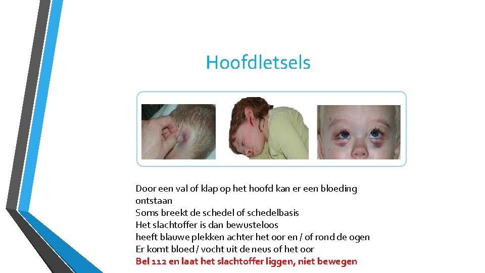 Hoofdletsels Door een val of klap op het hoofd kan er een bloeding ontstaan